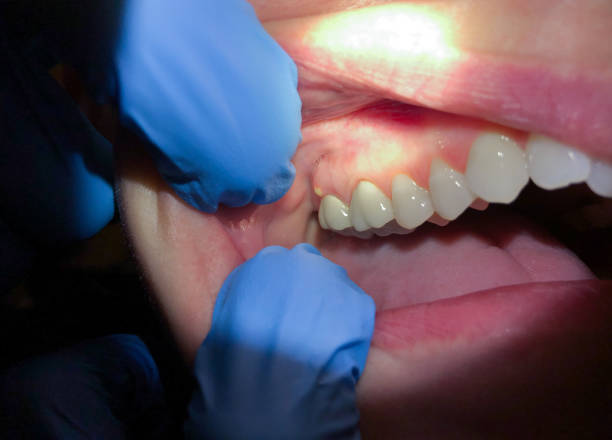 Best Pediatric Emergency Dentist in Hilton, NY