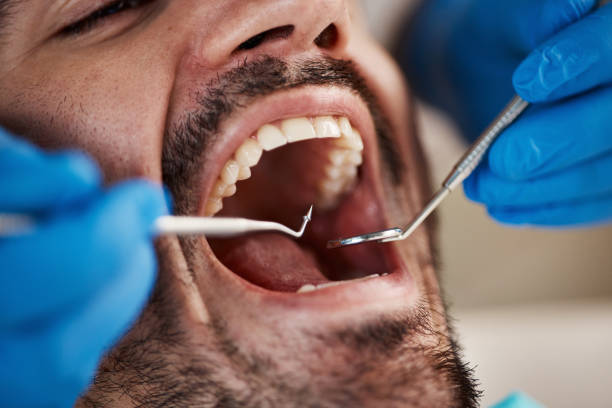 Best Orthodontic Emergency Dentist in Hilton, NY